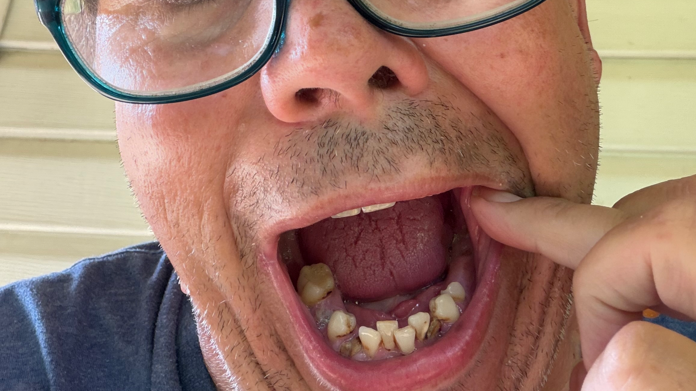 Dustin’s Dental Expense