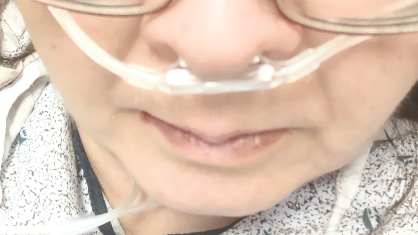 Medical Related Expenses