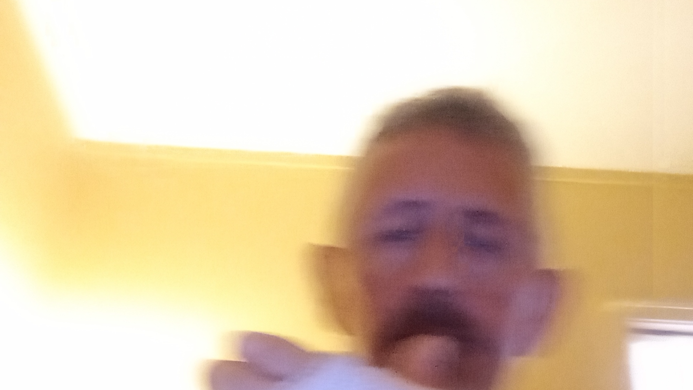 Severe trauma, broken femur , broken hand