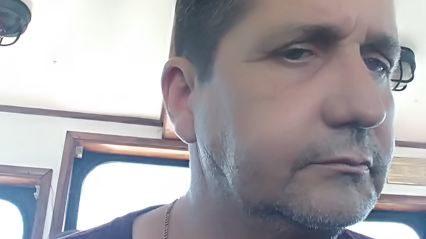 Teeth removed and replaced