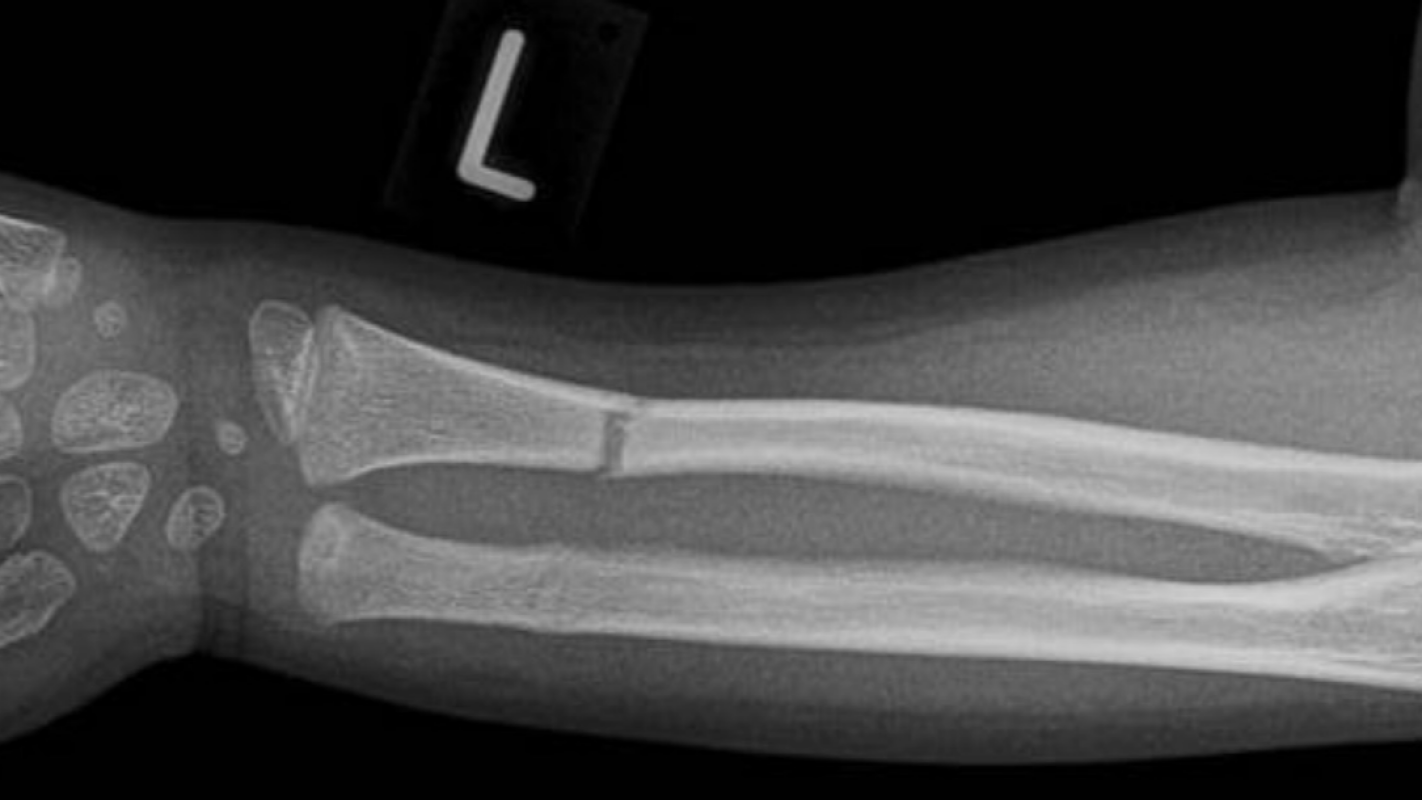 urgent medical bill