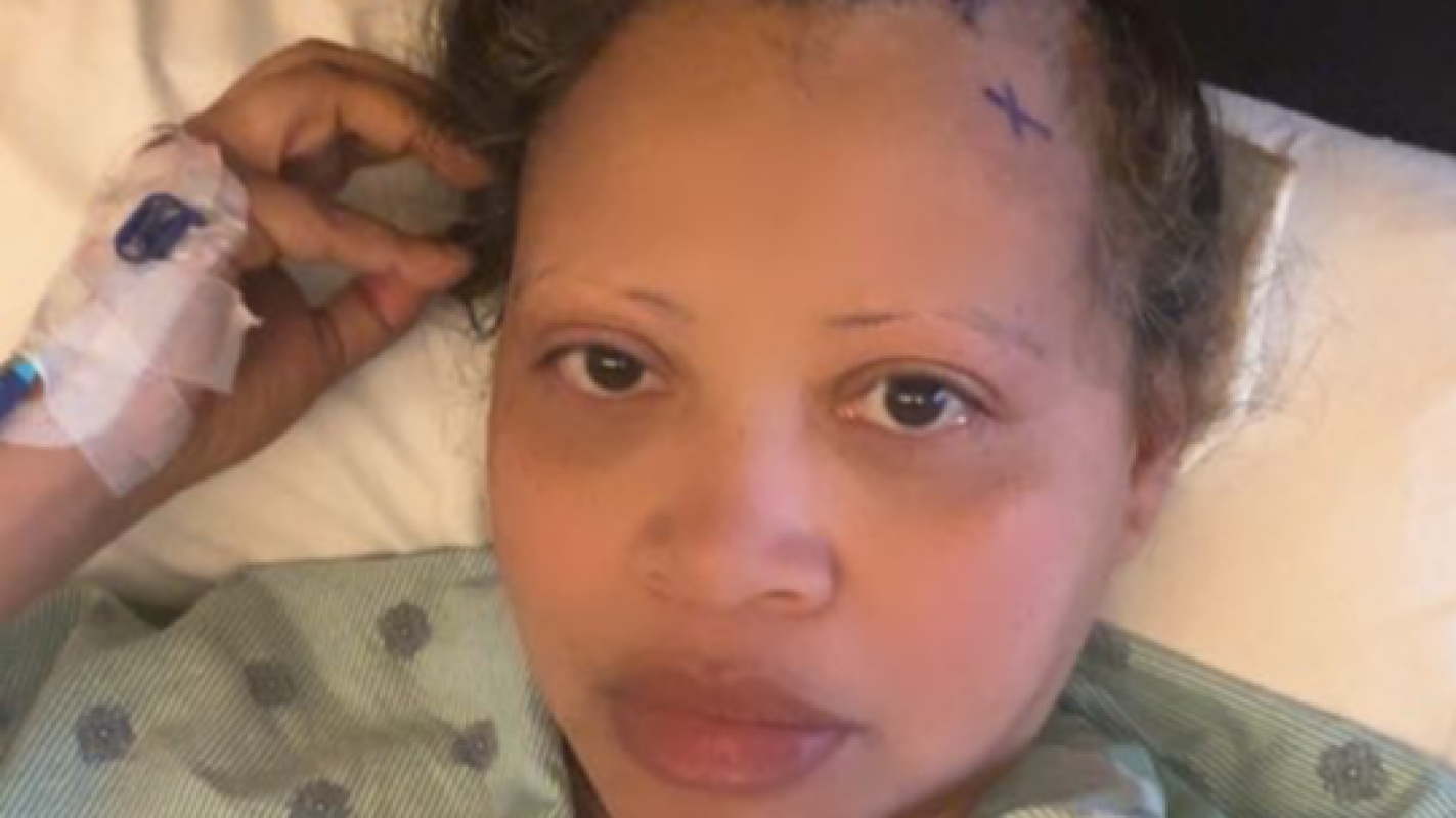 Supporting Nancy's Brain Aneurysm Recovery