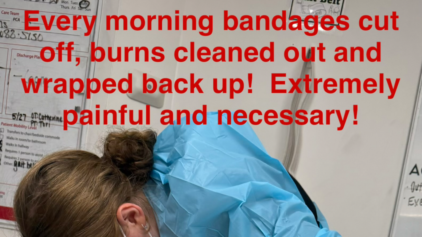 Jennifer Eads Burn Recovery