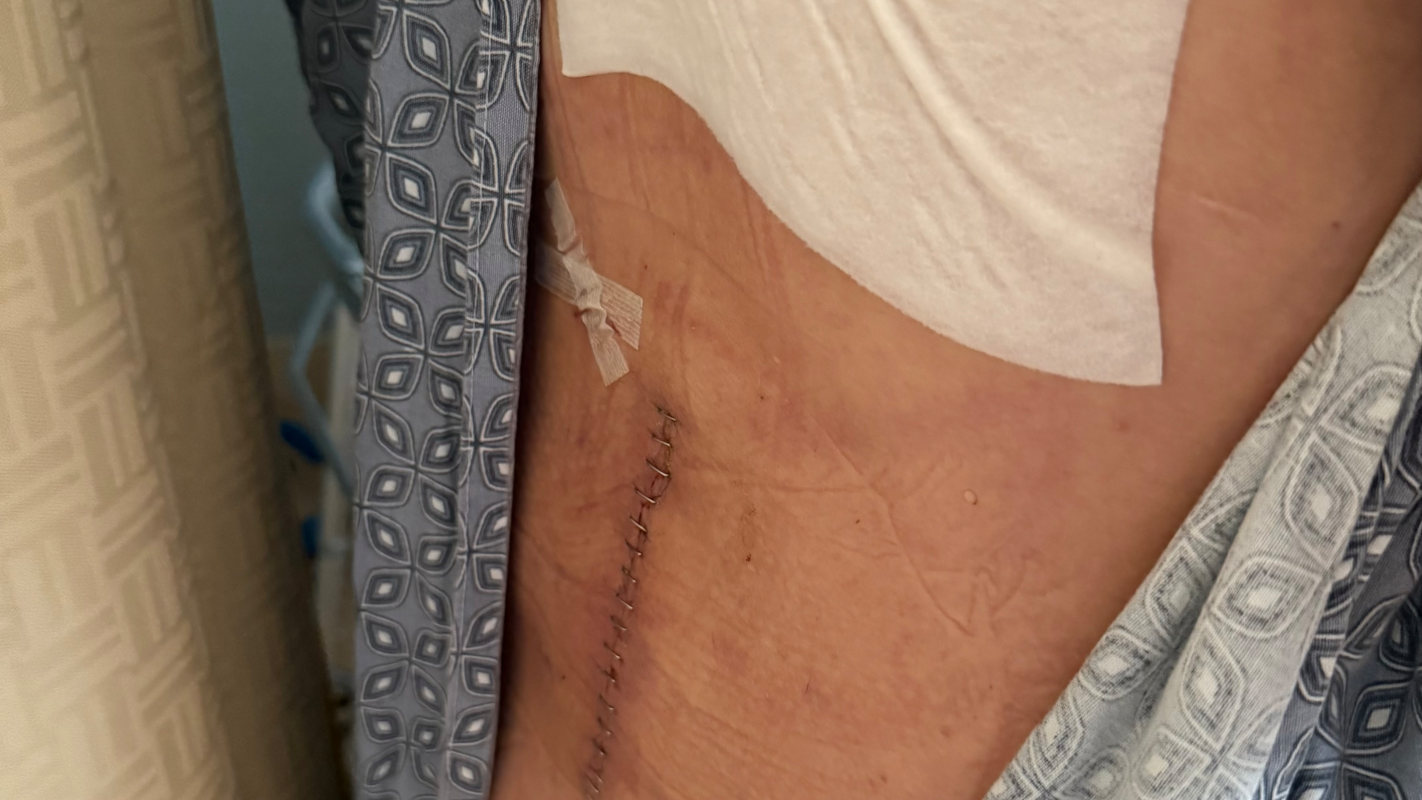 Saving my ability to walk