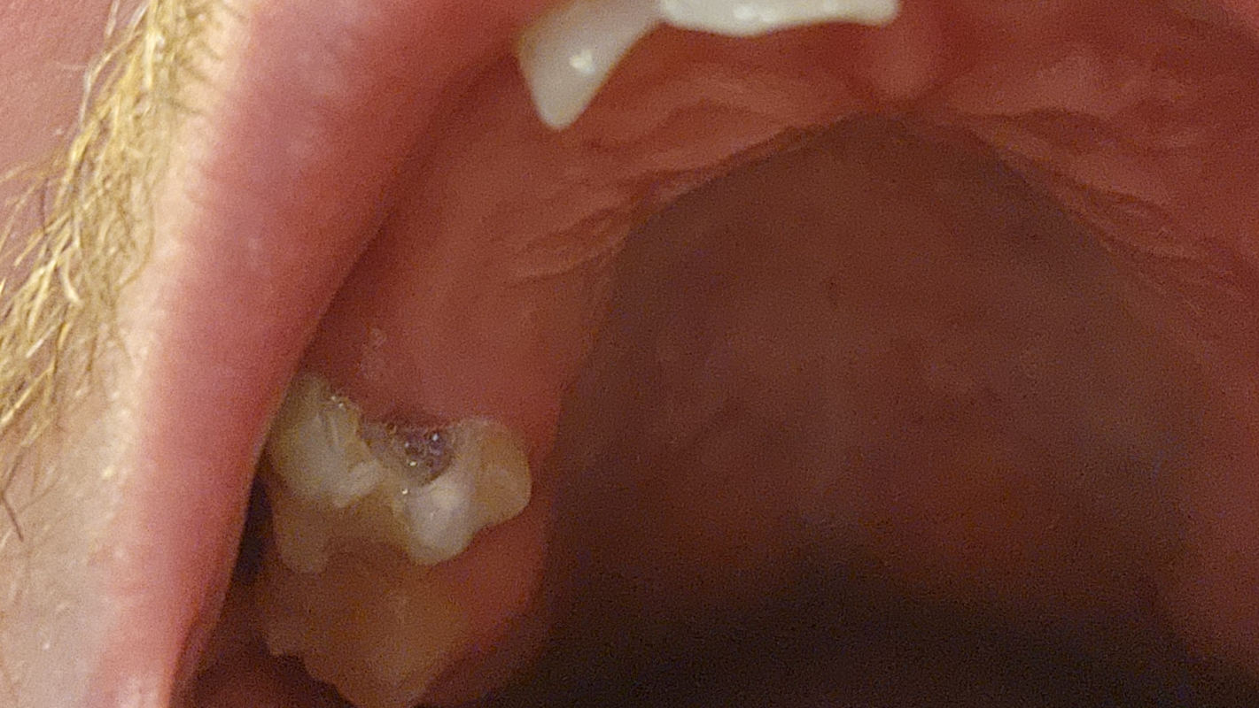 dental surgery
