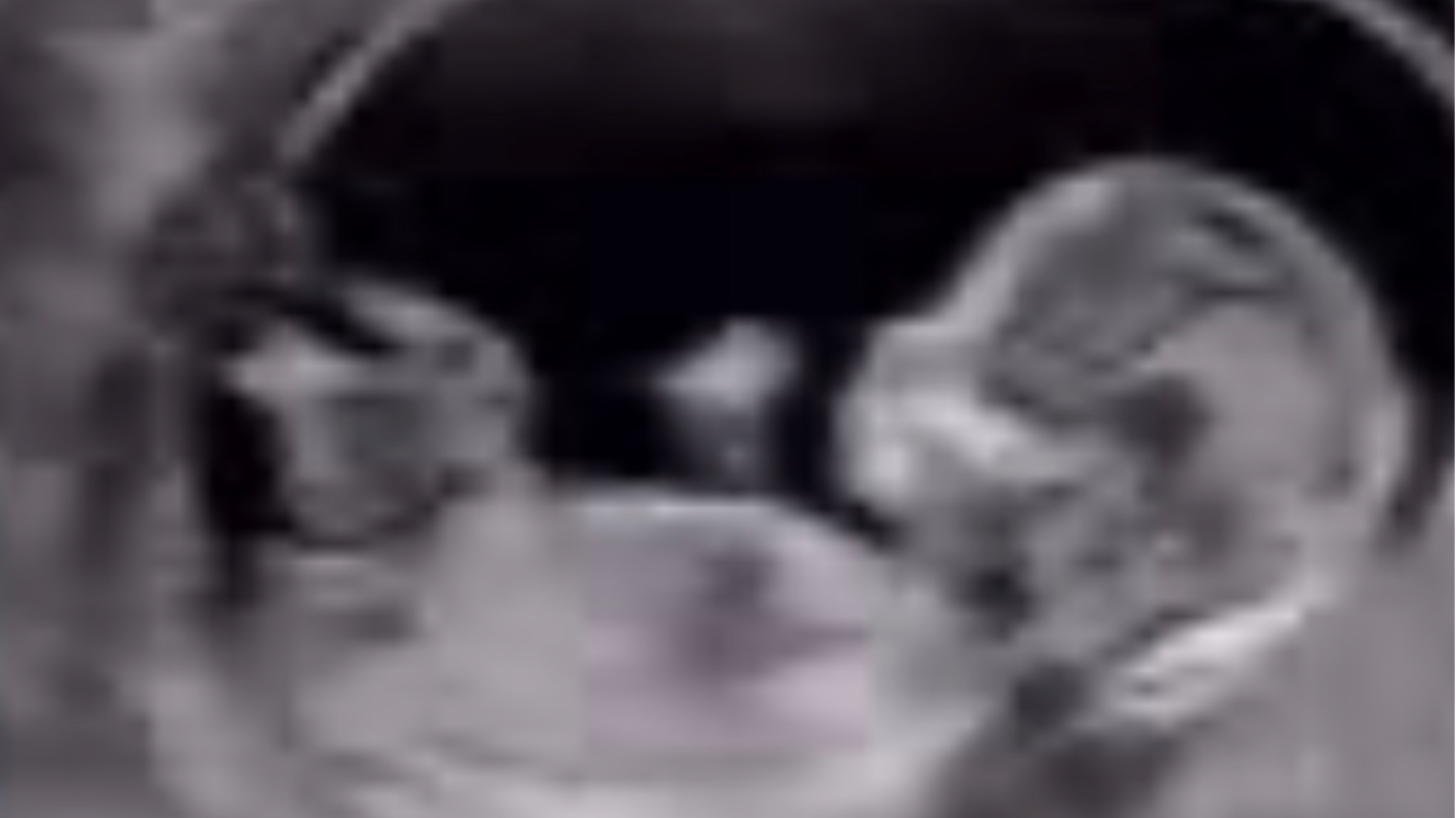Unexpected Pregnancy