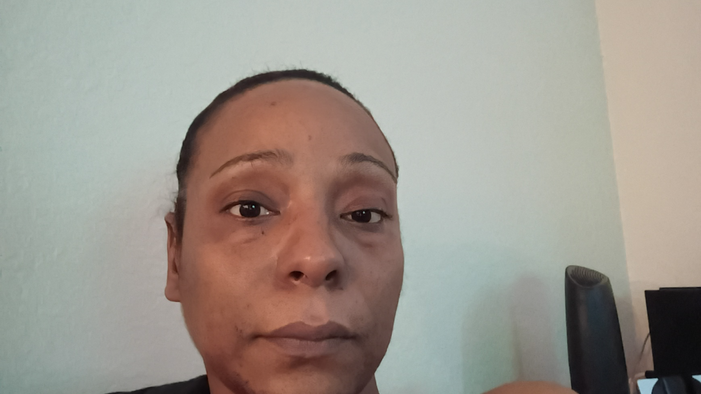 Please help me stay housed while I battle unexplained neurological issues