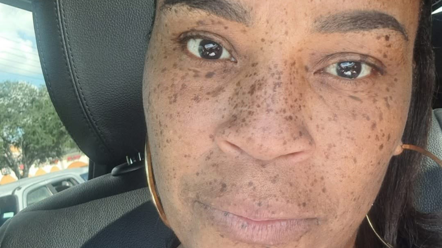 Kalifa's Battle with Stage 4 Cancer