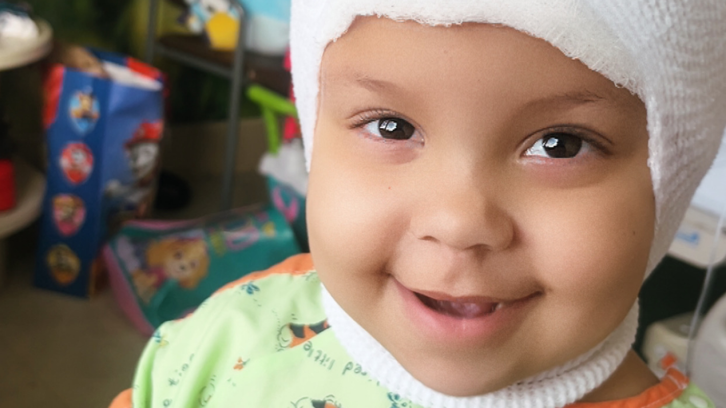 JuJu’s Radiation treatment