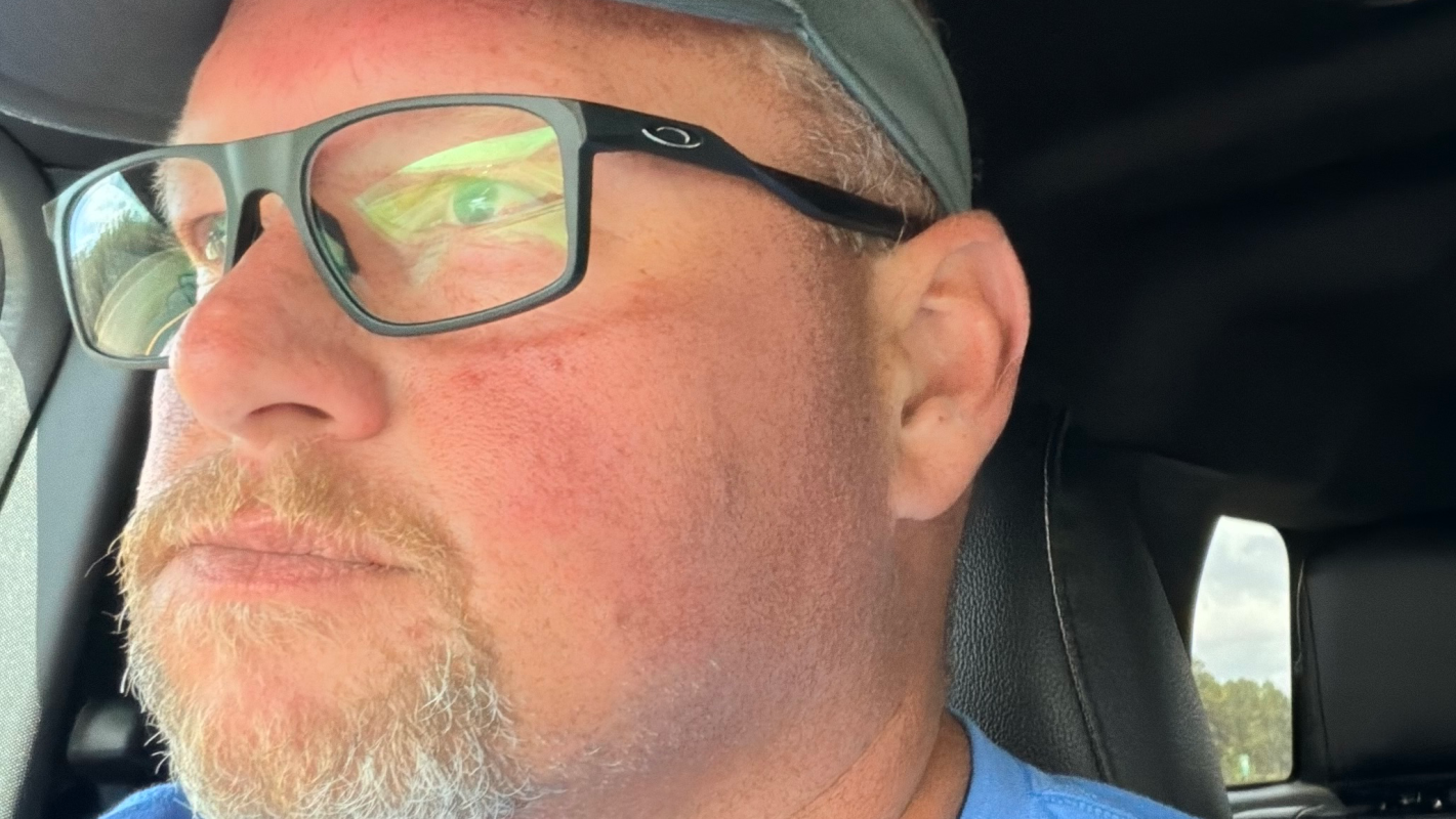 Cancer Medical expenses