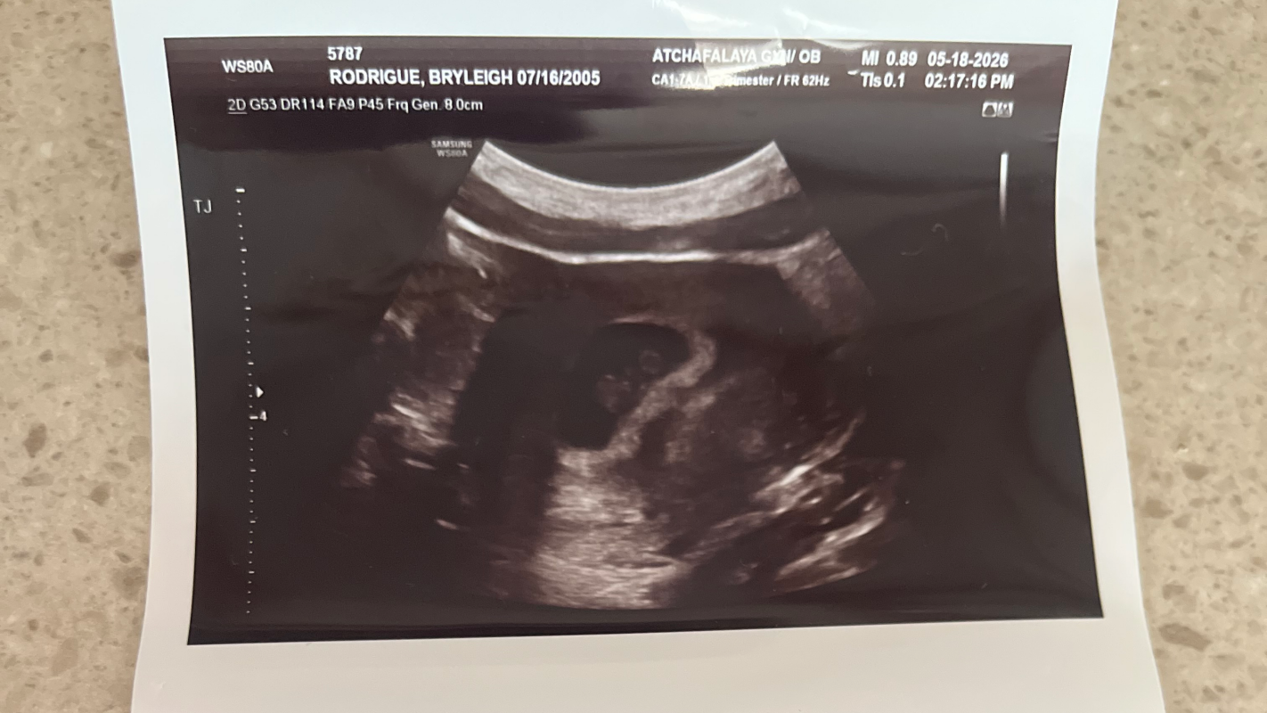 Need Help Before Baby Arrives