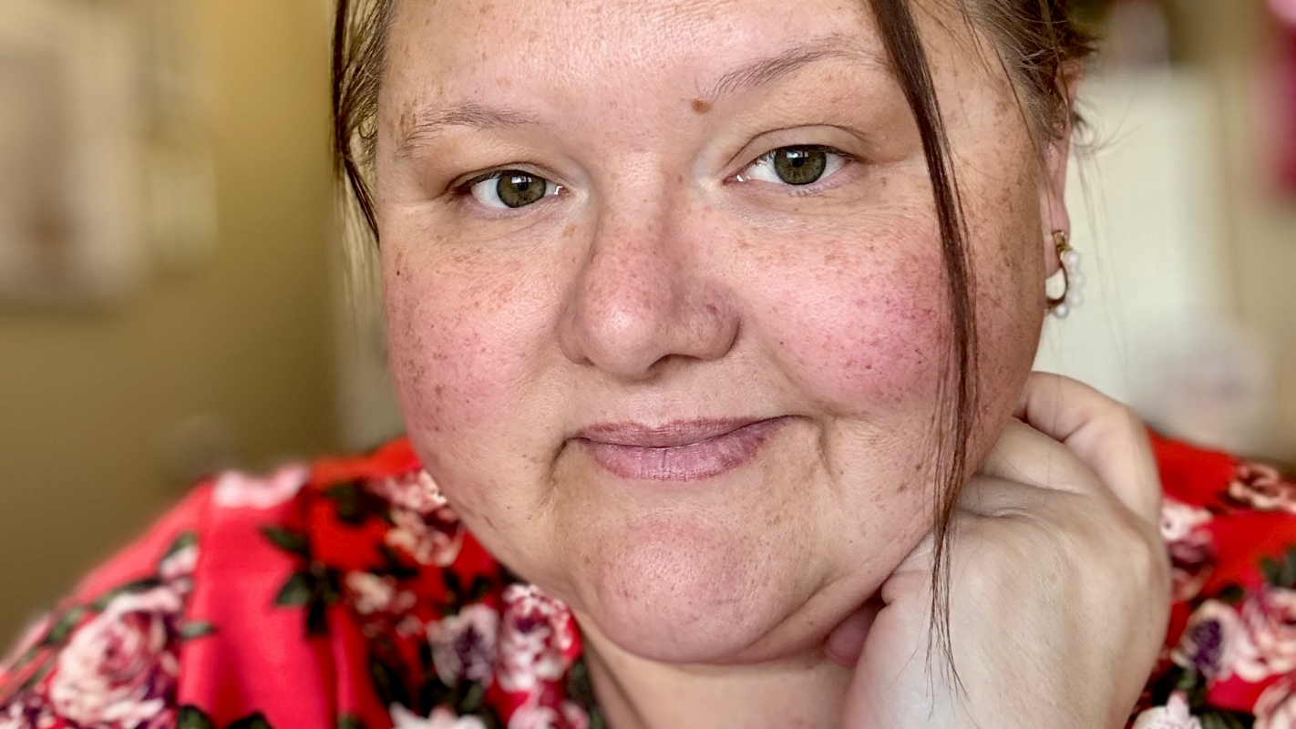 Help Restore My Smile Post Chemo