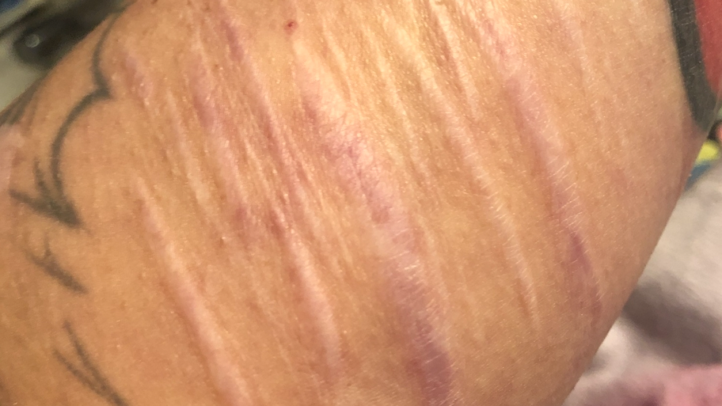 Leaving domestic violence