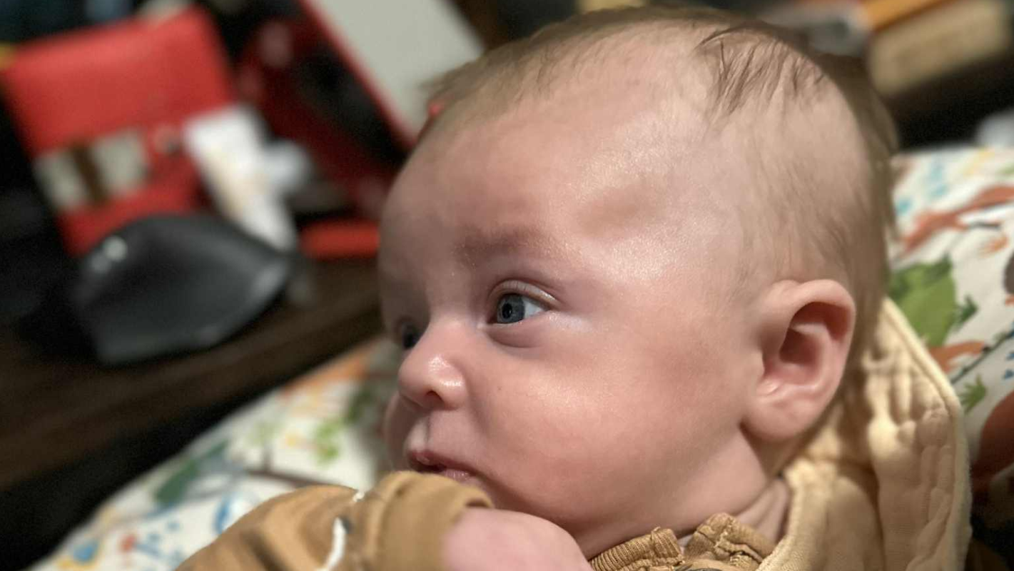 HOS Plagiocephaly DOC band