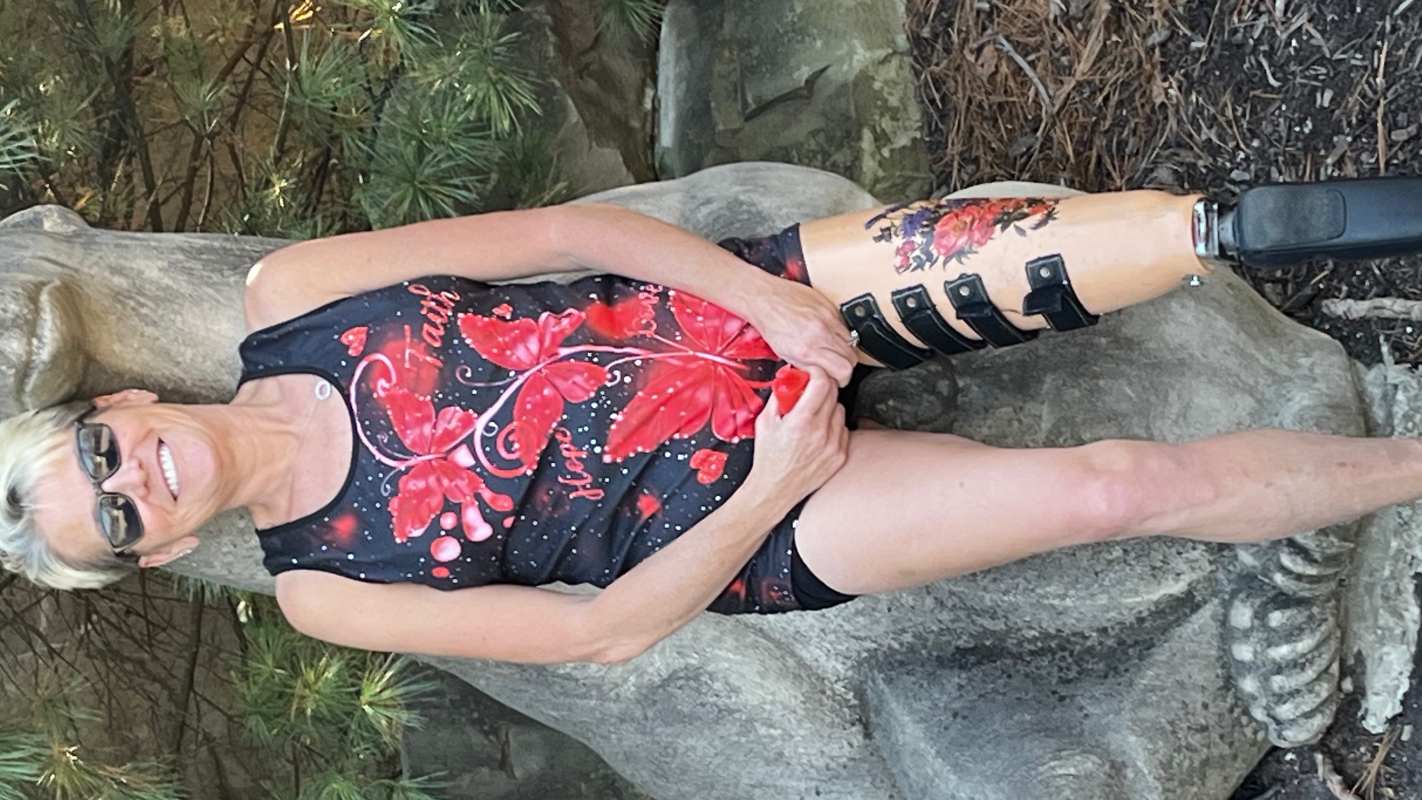 Amputee need a better way