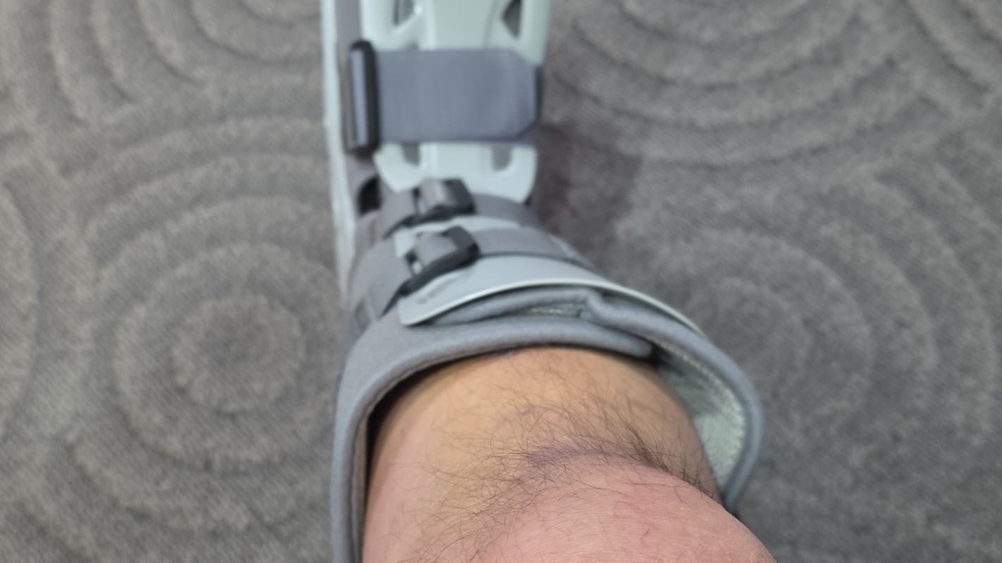 Broken ankle emergency funds