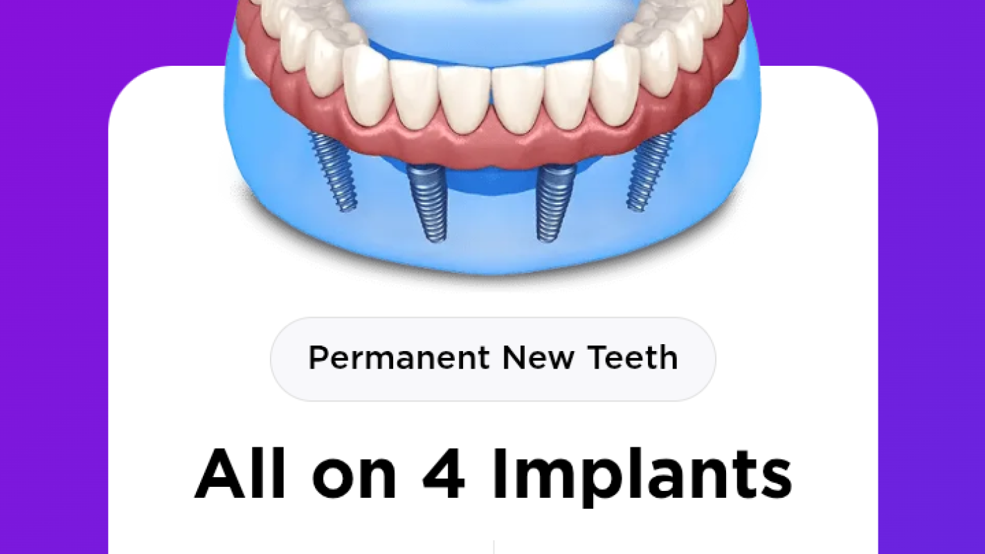 Dental implant dentures