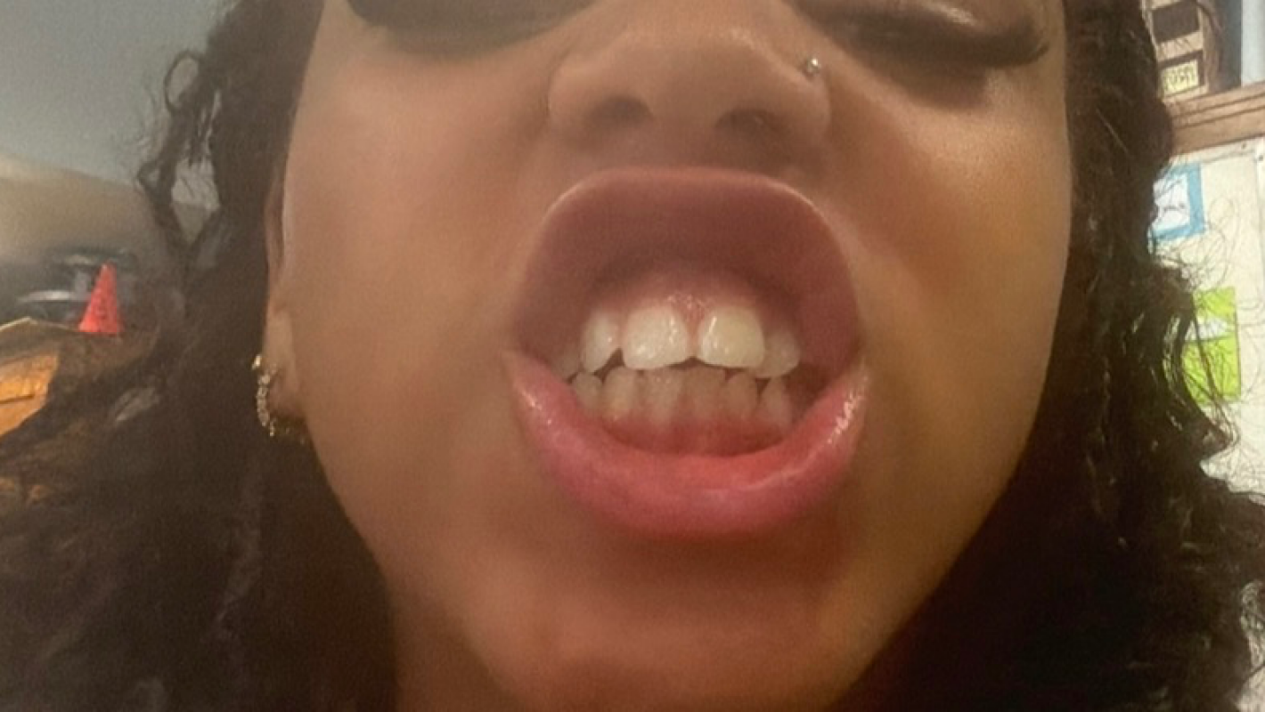 Getting my kids braces