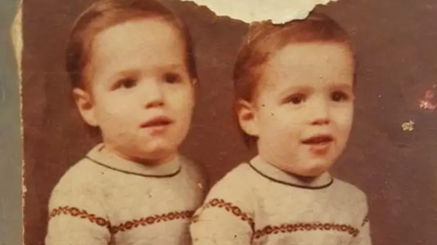 Christopher new eye and facial recontrutions