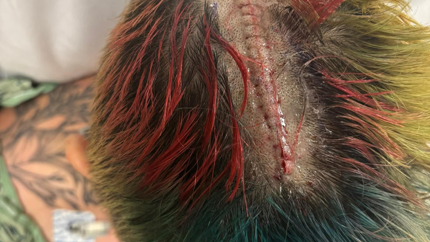 IN FOR THE FIGHT OF HER LIFE