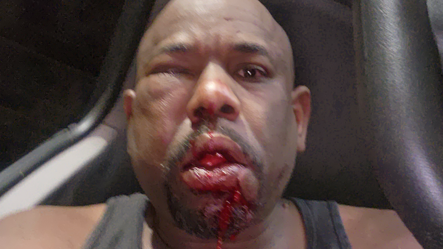 Hospital bills after being attacked