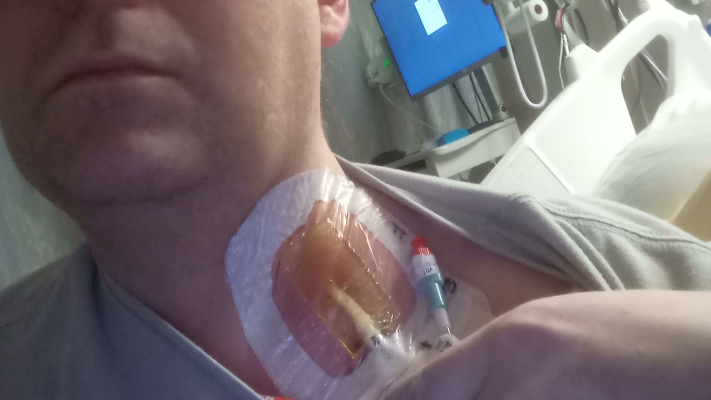 Help me with my vaccine injury. GBS WITH AMSAN!!!!