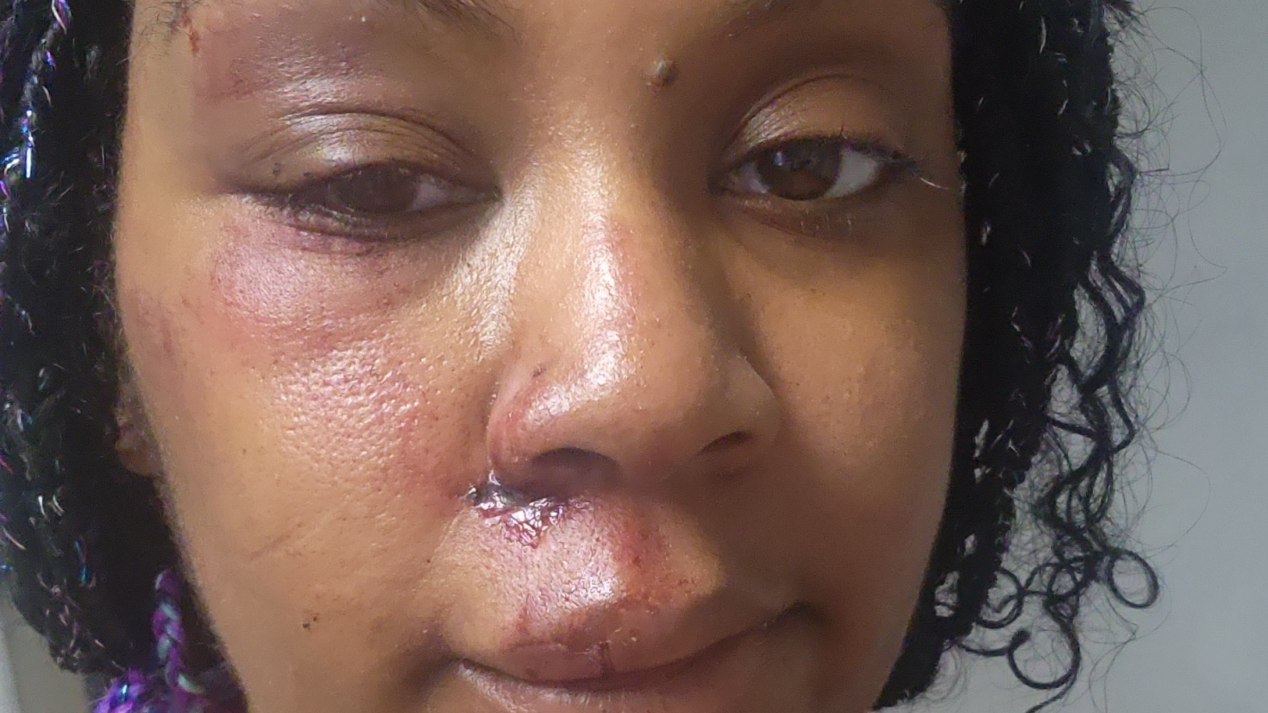 Rent aft Car Accident