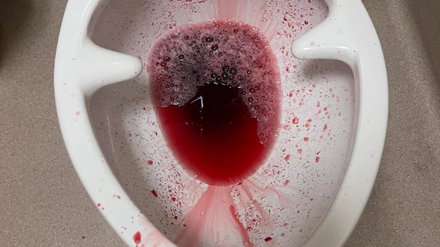 For my bladder & prostrate cancer removed & treatments