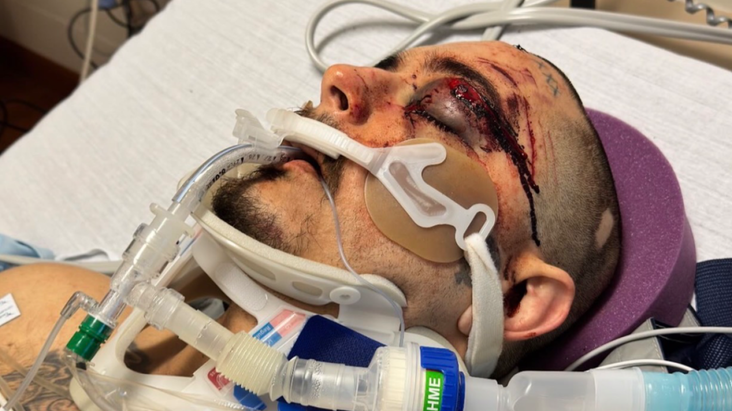 Father of 2 hit by semi on highway