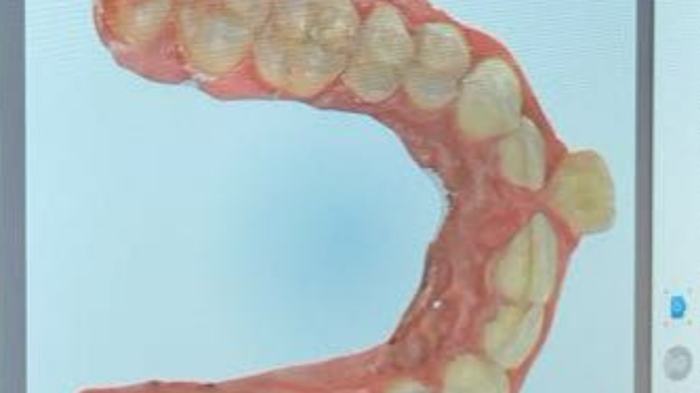 Orthodontic care for jaw pain