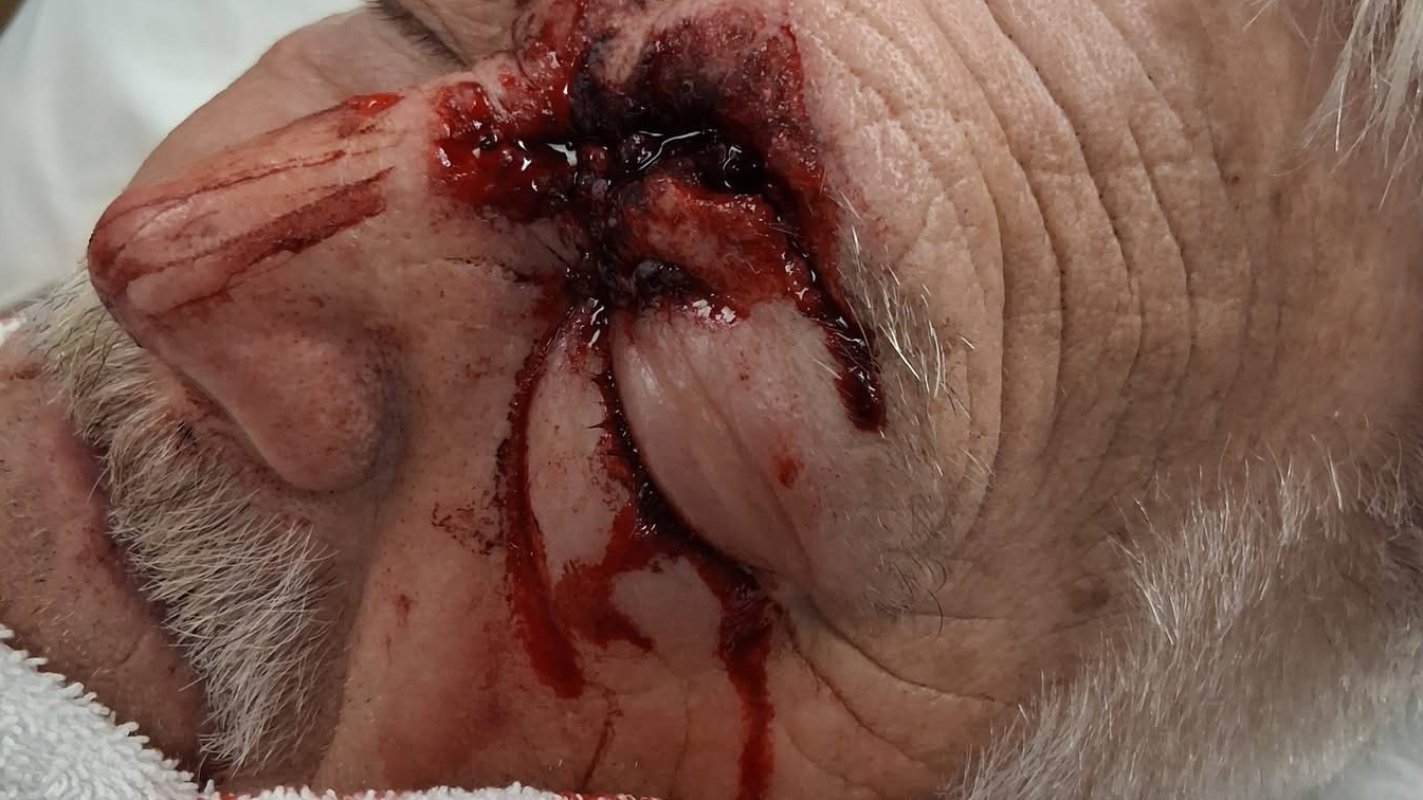 Dave Bush medical funds