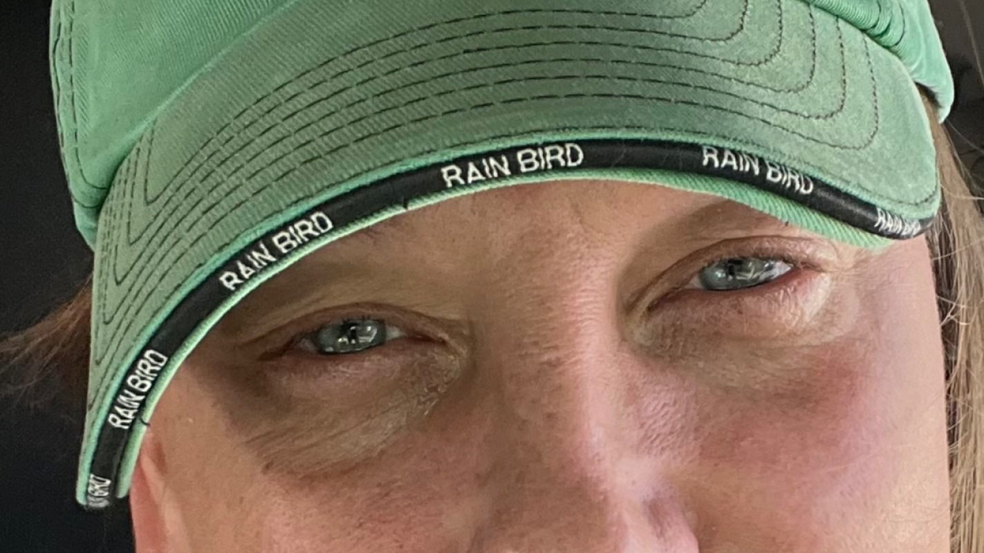 Need emergency Retina detachment surgery