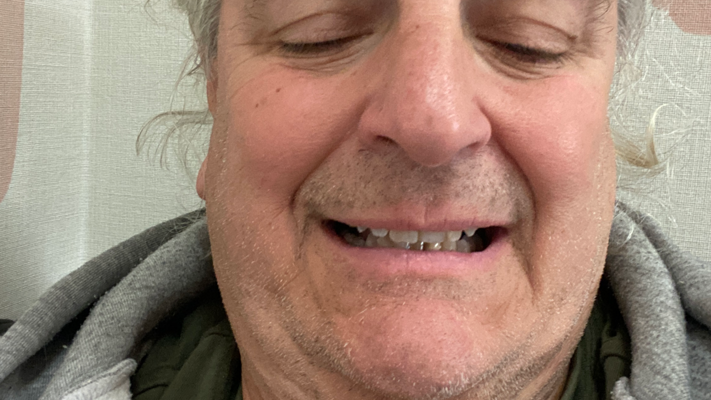 MTF bottom surgery