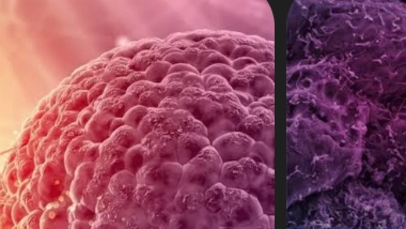 Cancer ♋️ patient