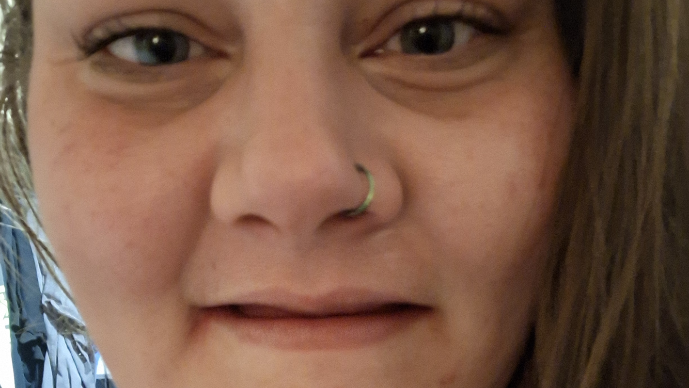 Help me smile AGAIN!