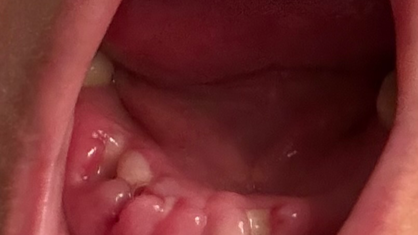 Expenses accrued for dental care and cancer treatments.