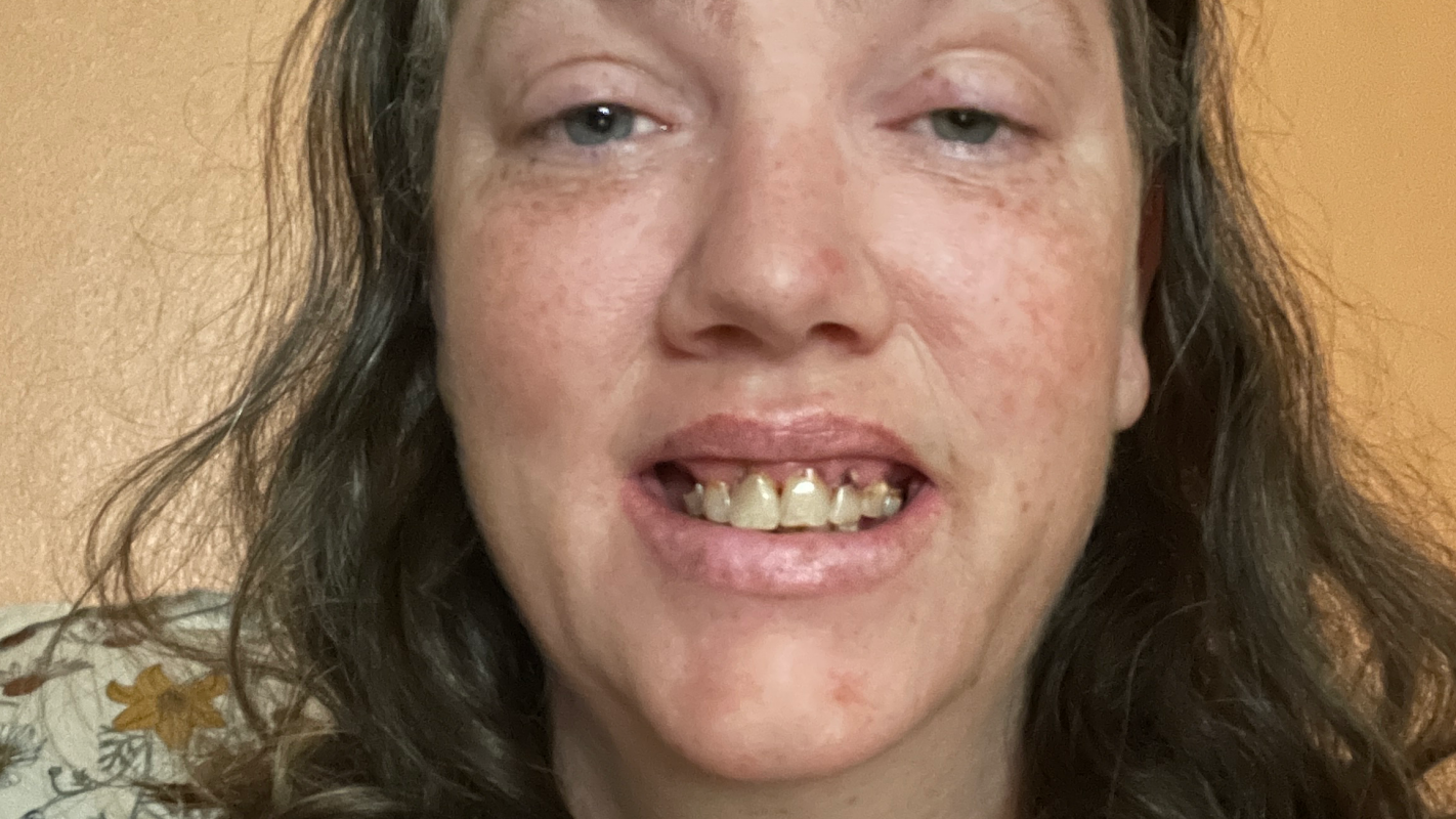 Dental help