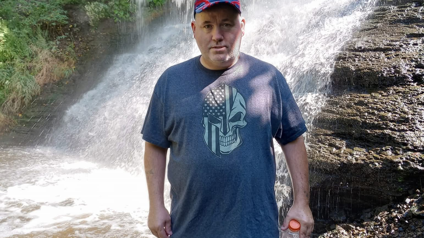 Dan's stage 2 cancer surgery