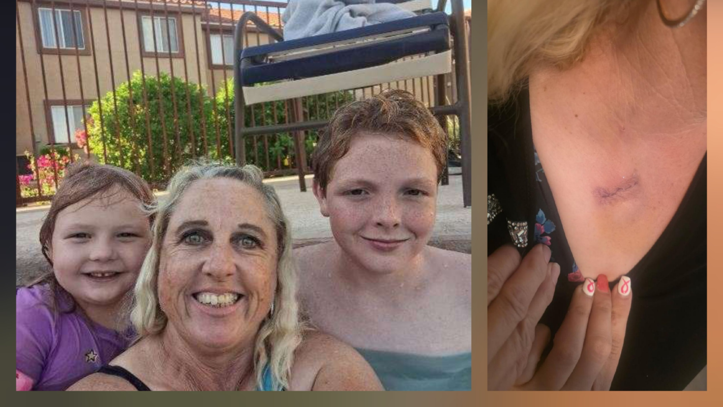 Breast cancer medical