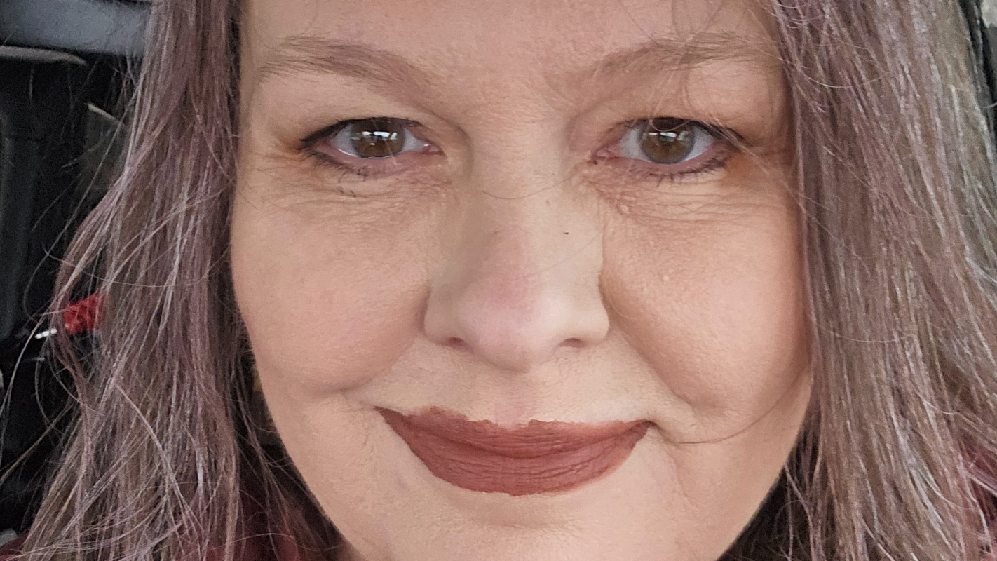 Help a veteran get iovera procedure