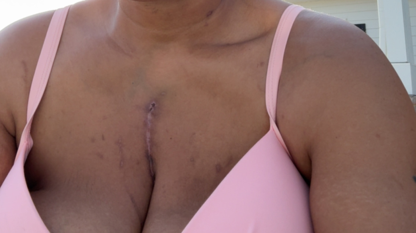 Bills due to medical issues