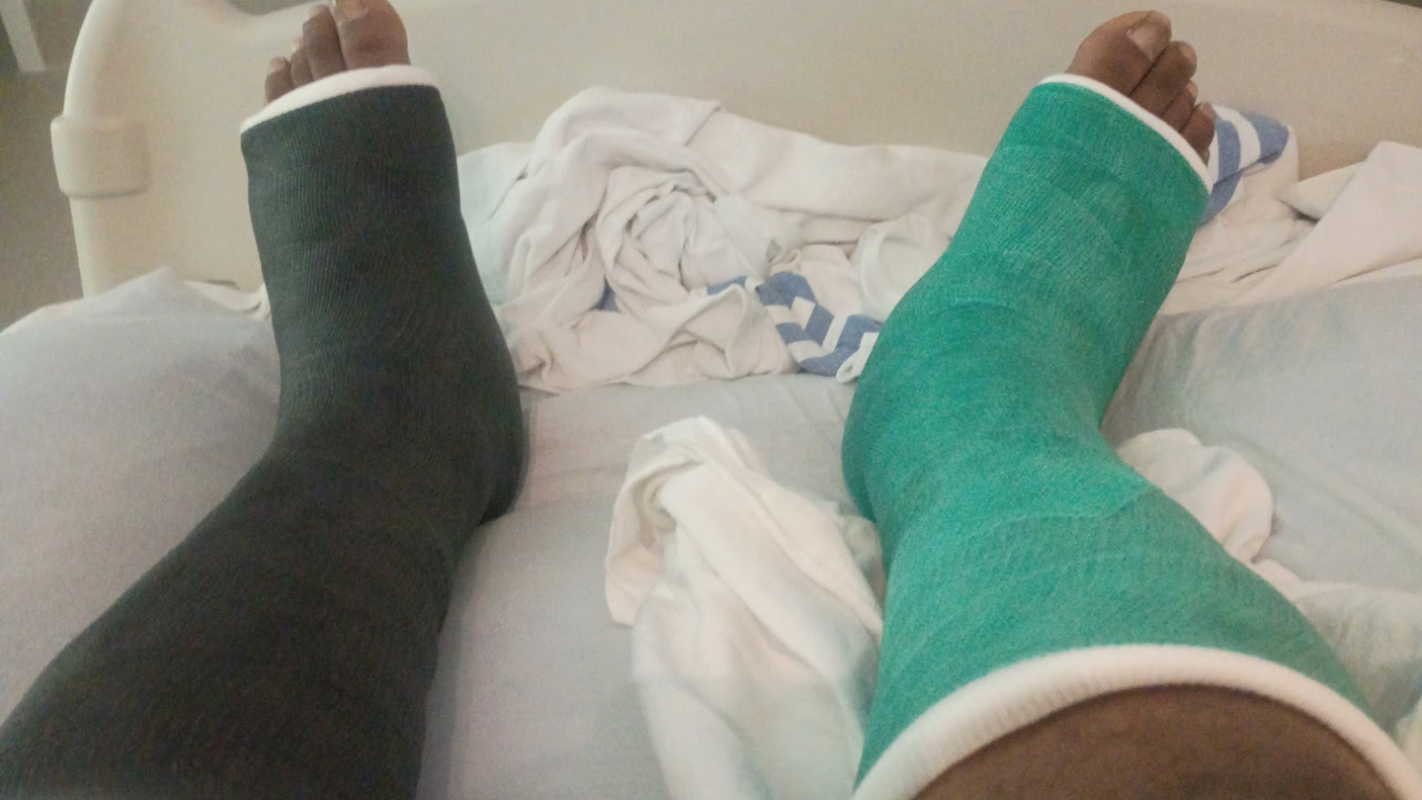 Speedy recovery for Kisroythe fundraising funds is to Kisroy.. he broke both of his legs and can not walk or work..