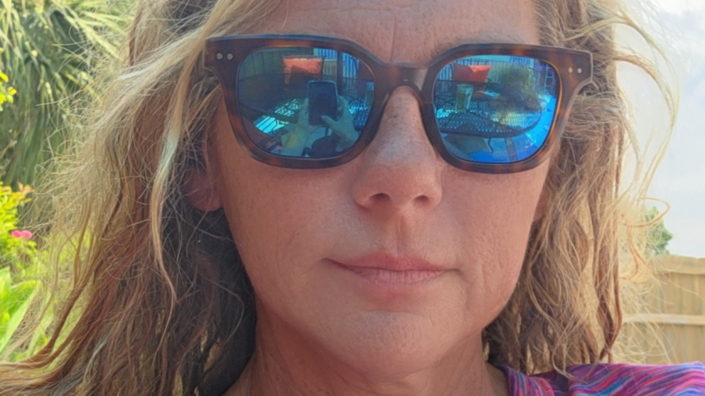 Severe pectus excavatum Surgery