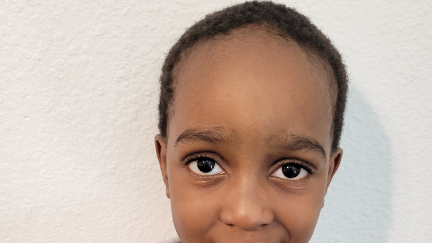 Stem Cell Treatment for Autism