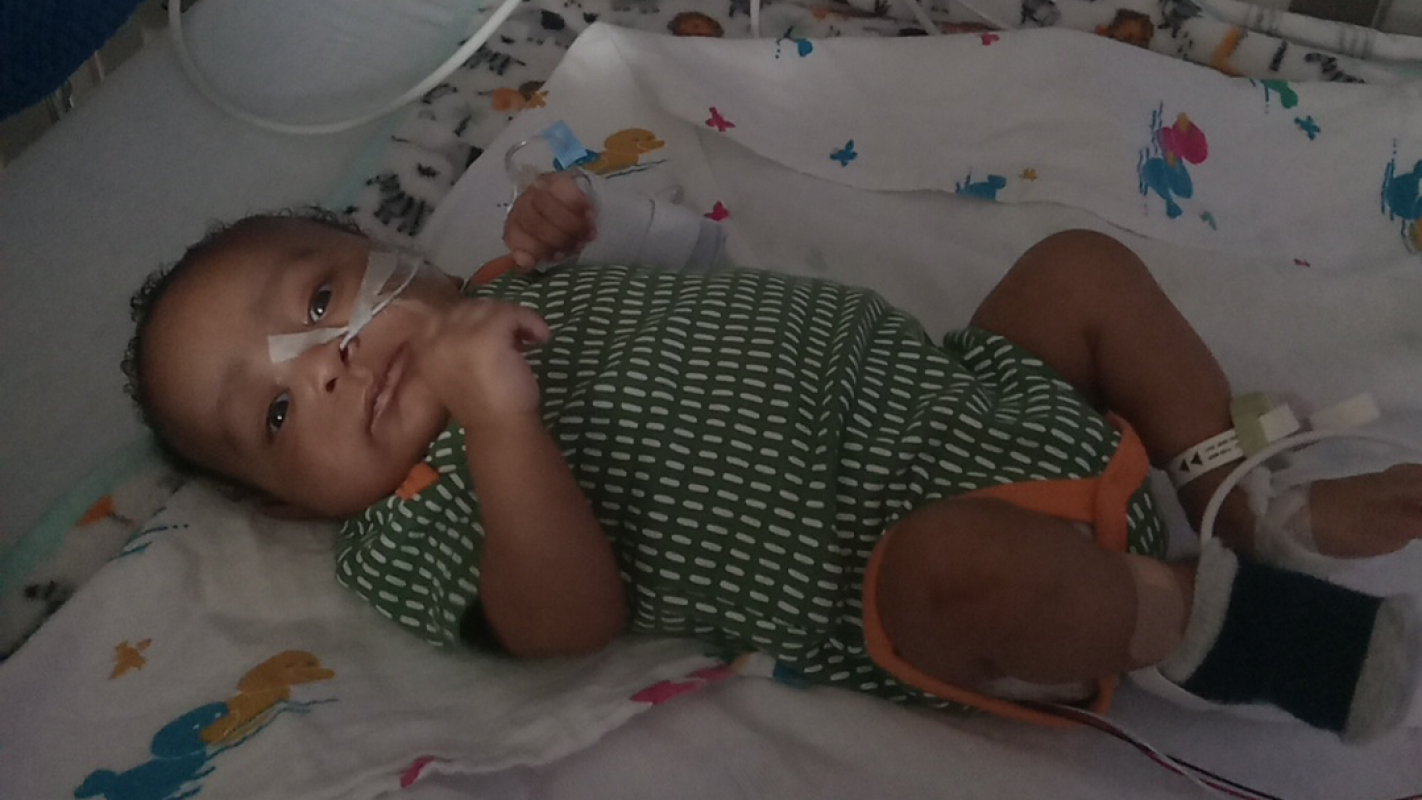 Kidney transplant