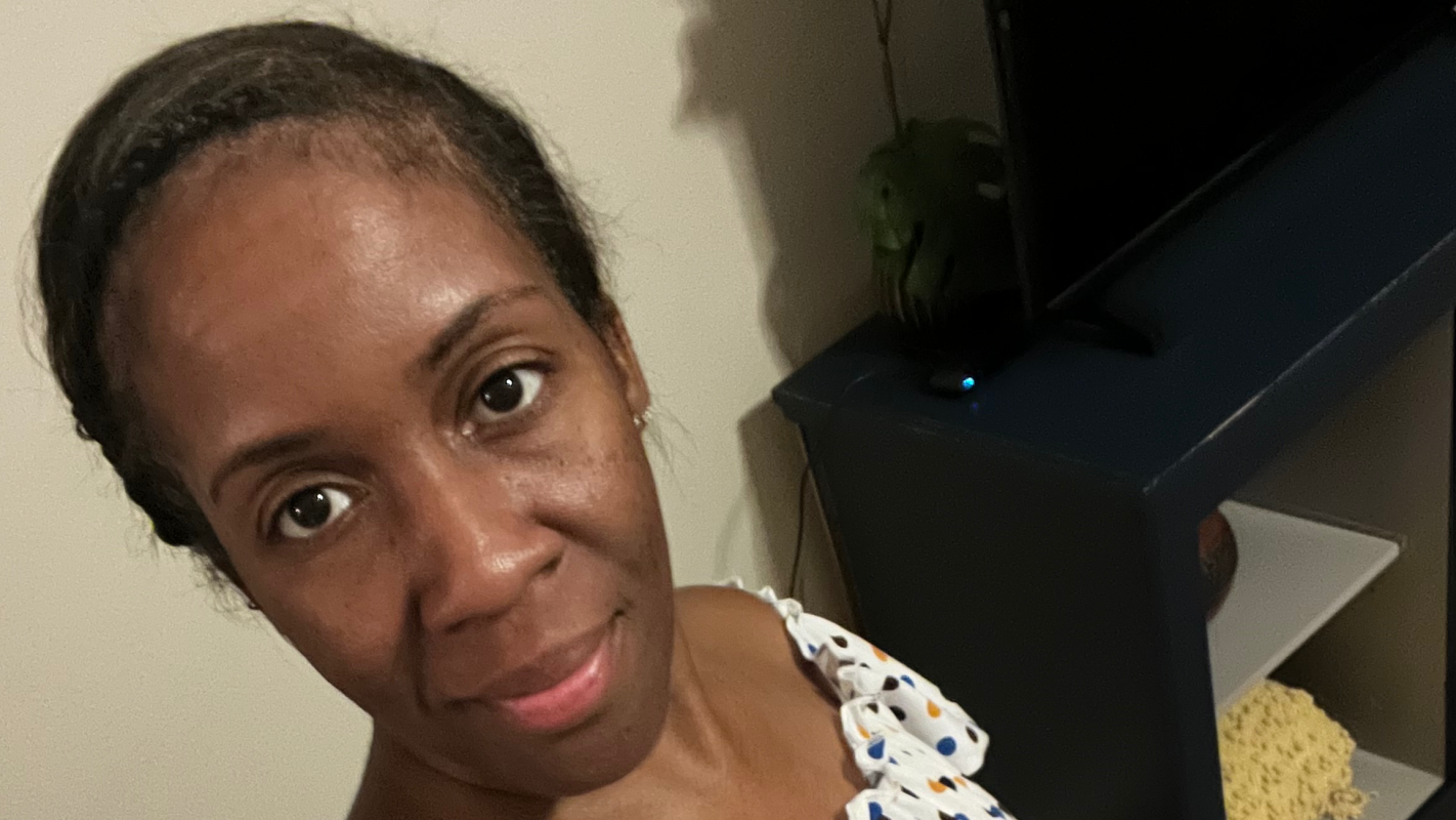 Dental Pain Is Impacting My Health — Please Help