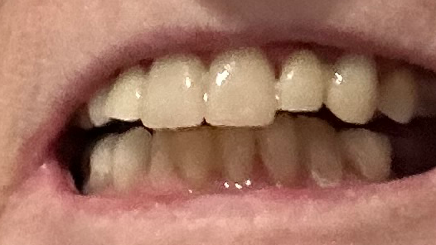 Dental work at Dental Clinic