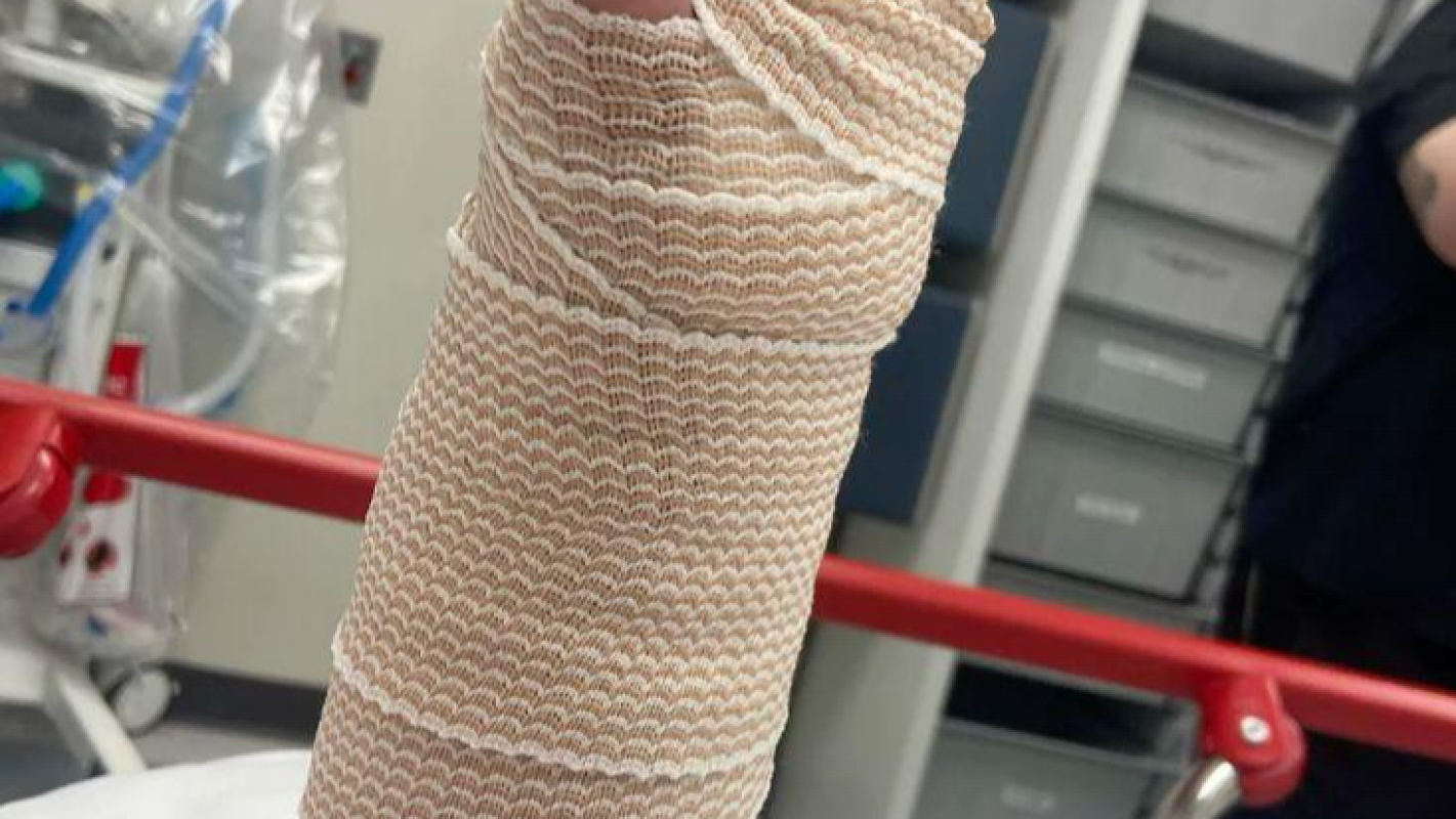 Samantha’s Recovery Fund After a Catastrophic Hand Injury