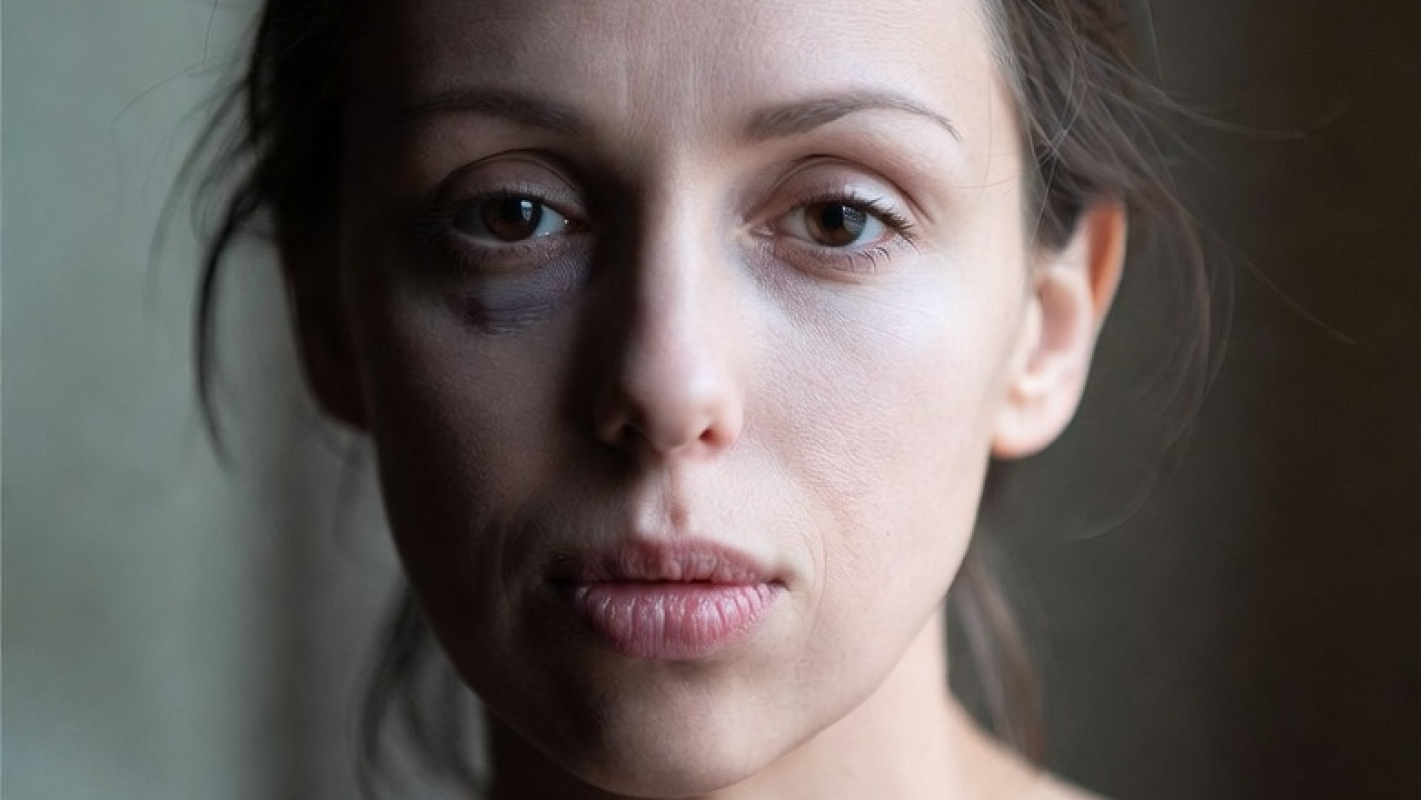 Help Mykala battle cancer