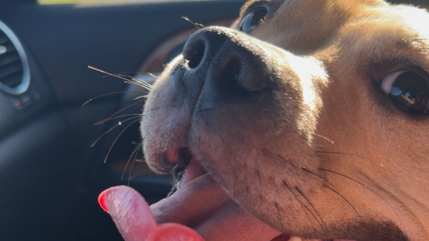 FHO Surgery for Zahra